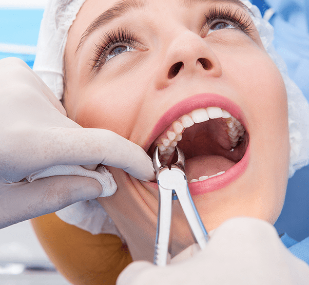 Dental Tooth Extractions