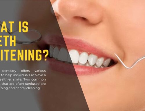 Cosmetic Dentists In Boca Raton Talks Teeth Whitening vs Dental Cleaning
