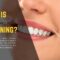 Cosmetic Dentists In Boca Raton Talks Teeth Whitening vs Dental Cleaning
