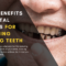 Dental Bridges In Boca Raton For Replacing Missing Teeth