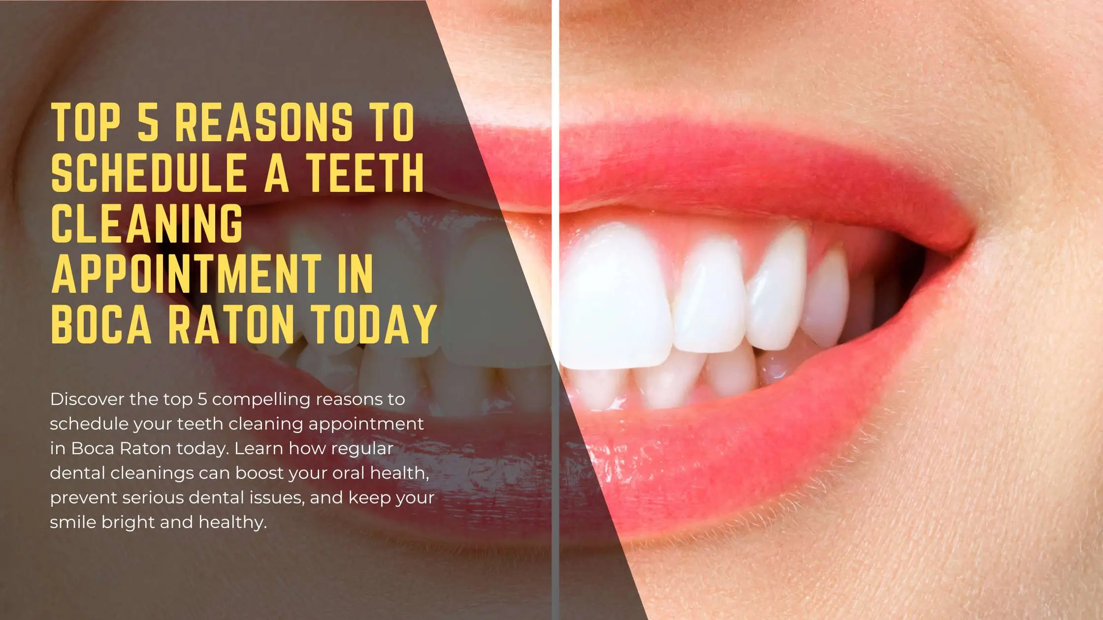 Teeth Cleaning Appointment in Boca Raton Bright Horizons Dental