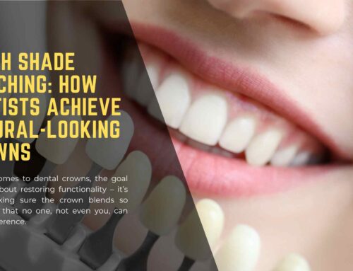 Tooth Shade Matching: How Dentists Achieve Natural-Looking Crowns