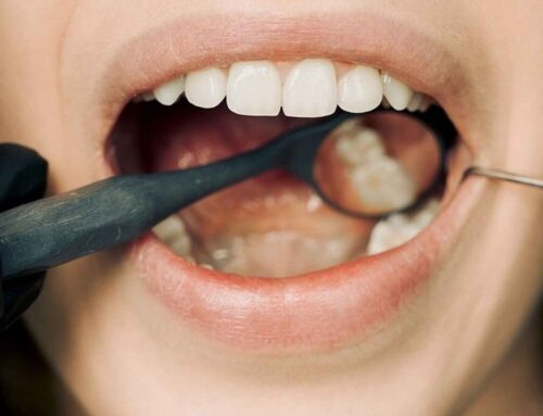 Can Dentists Diagnose Oral Cancer? Here’s What You Need to Know