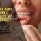 Why Do My Gums Bleed When I Floss