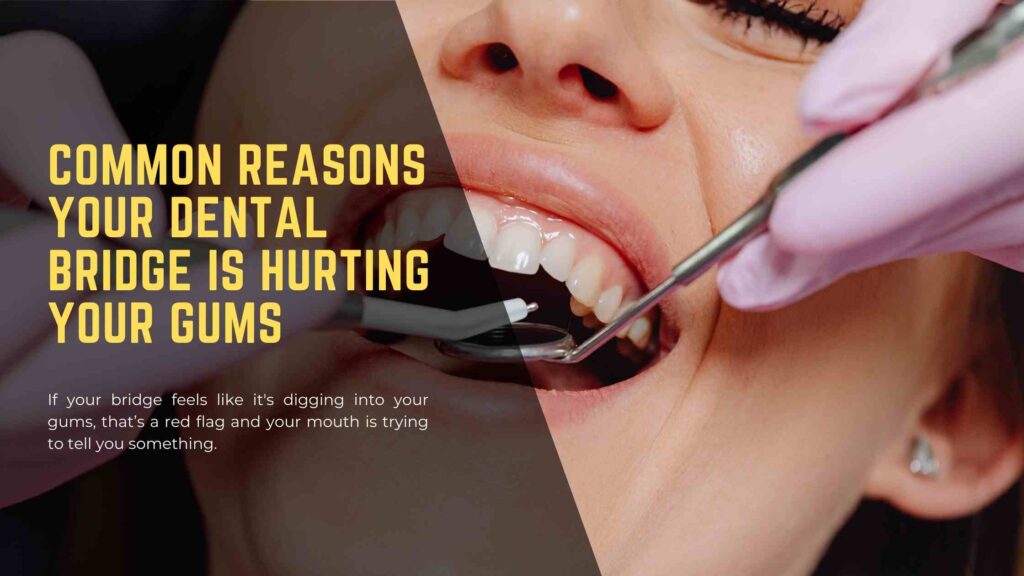 Common Reasons Your Dental Bridge Is Hurting Your Gums Common Reasons Your Dental Bridge Is Hurting Your Gums