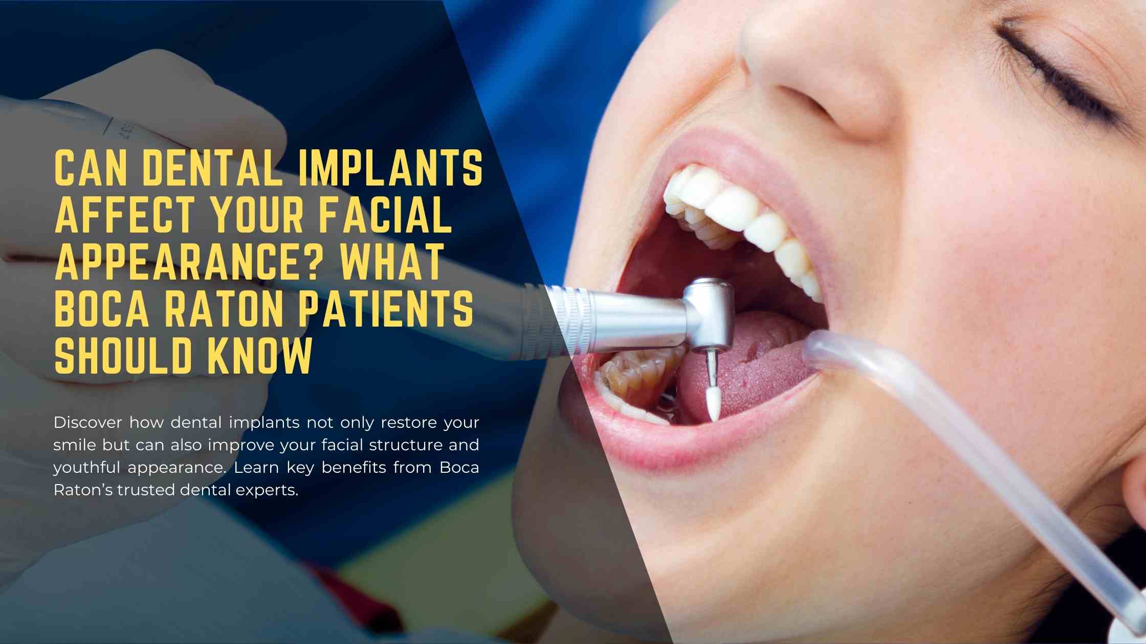 Can Dental Implants Affect Your Facial Appearance What Boca Raton Patients Should Know