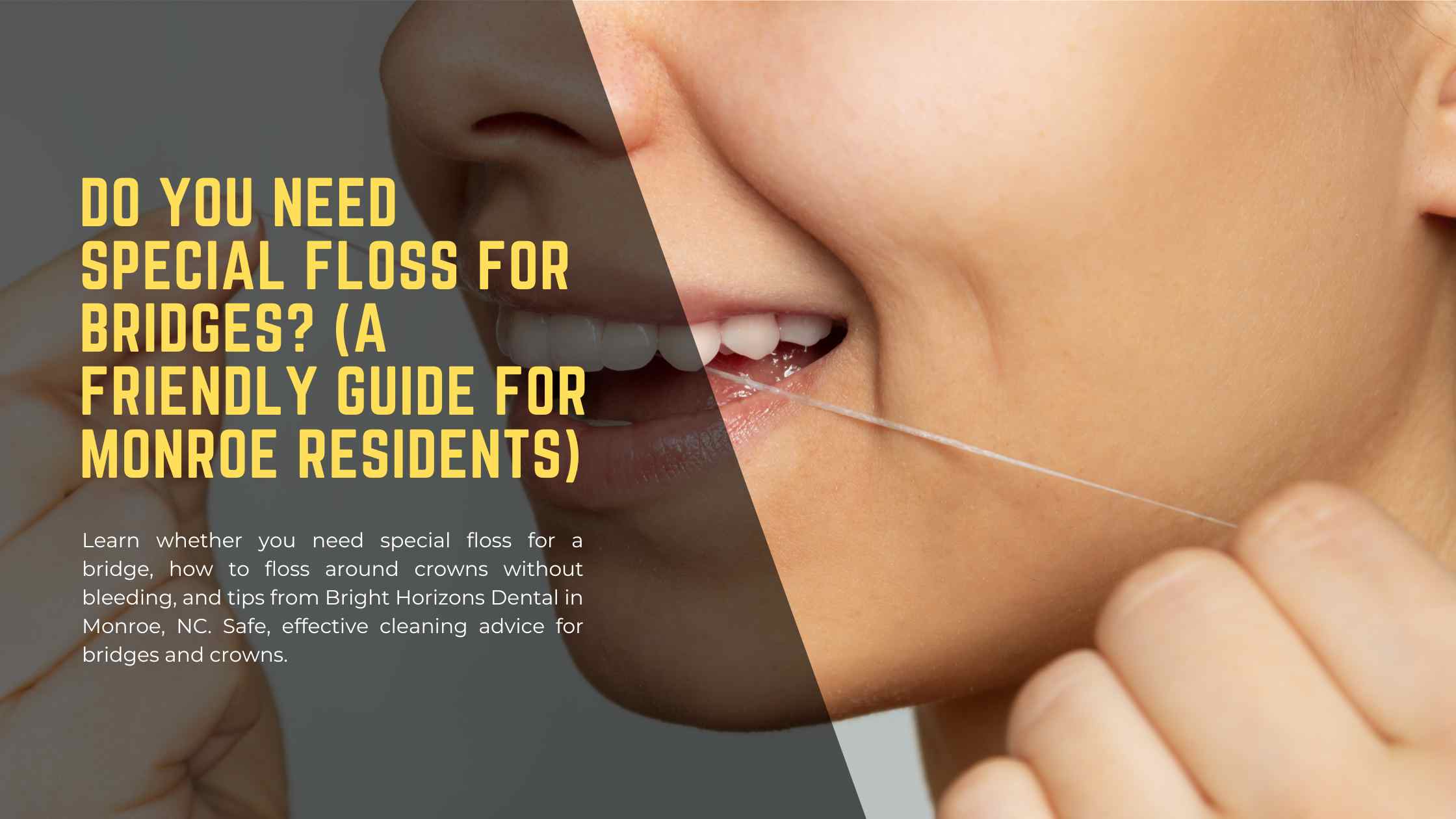 Do You Need Special Floss for Bridges (A Friendly Guide for Monroe Residents)
