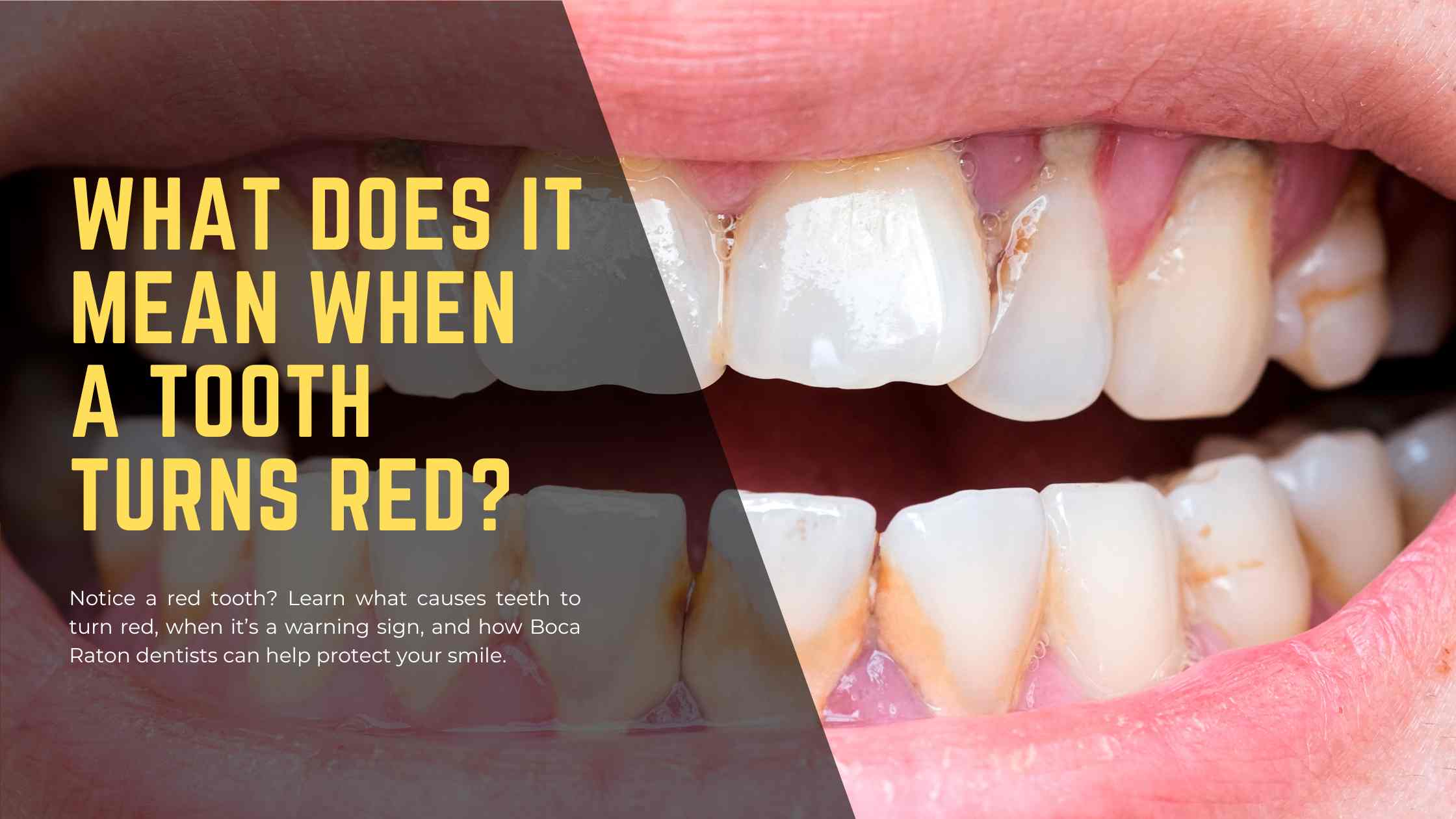 What Does It Mean When a Tooth Turns Red