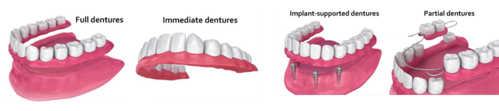 full or partial dentures boca raton