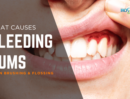 Why Do Gums Bleed When You Floss?