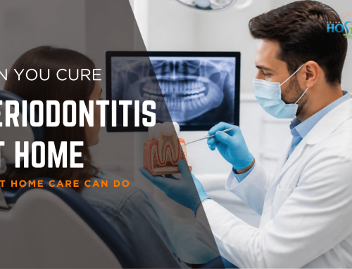 Can Periodontitis Be Cured at Home