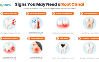 signs-you-may-need-a-root-canal