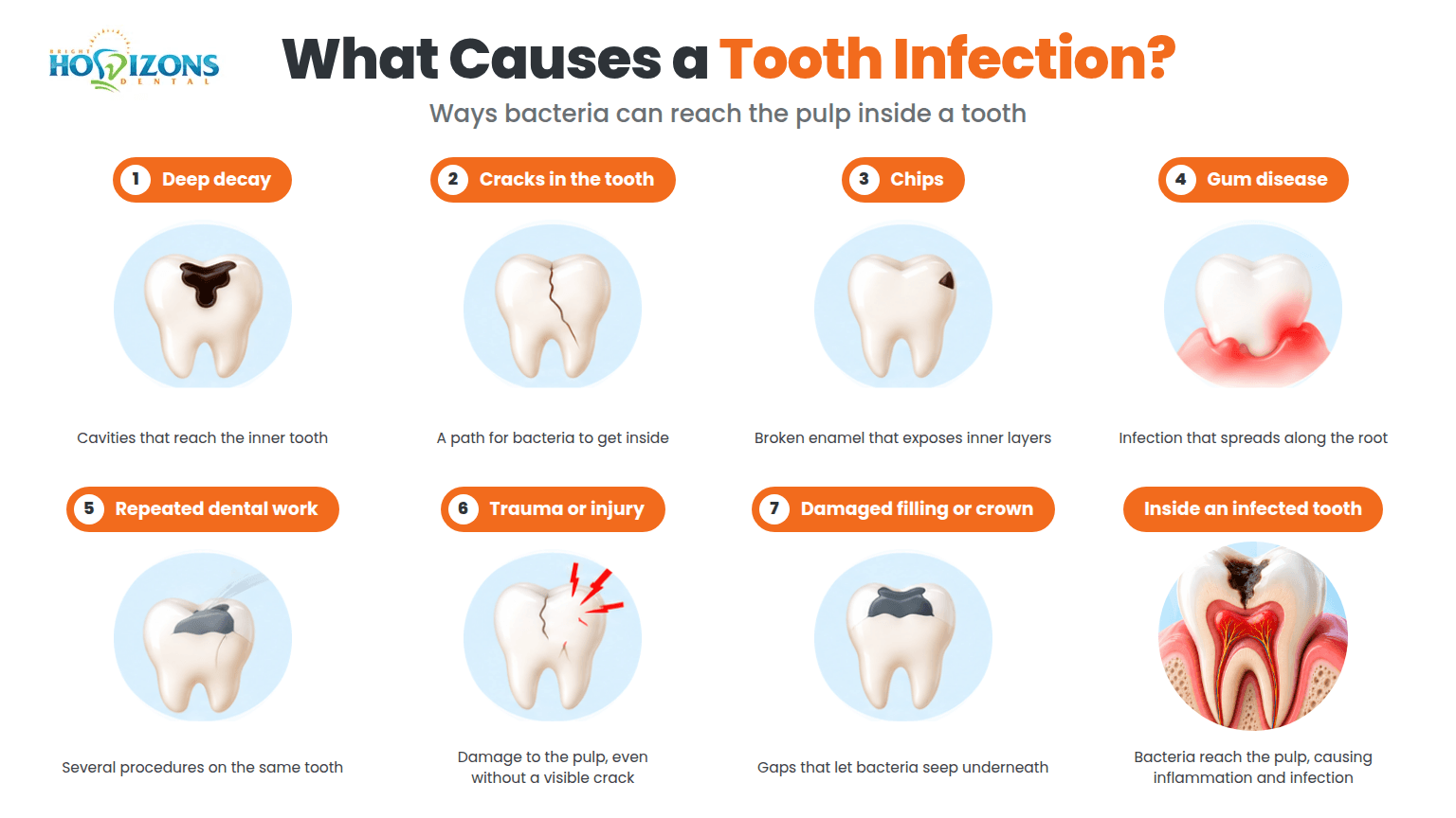 what-causes-a-tooth-infection
