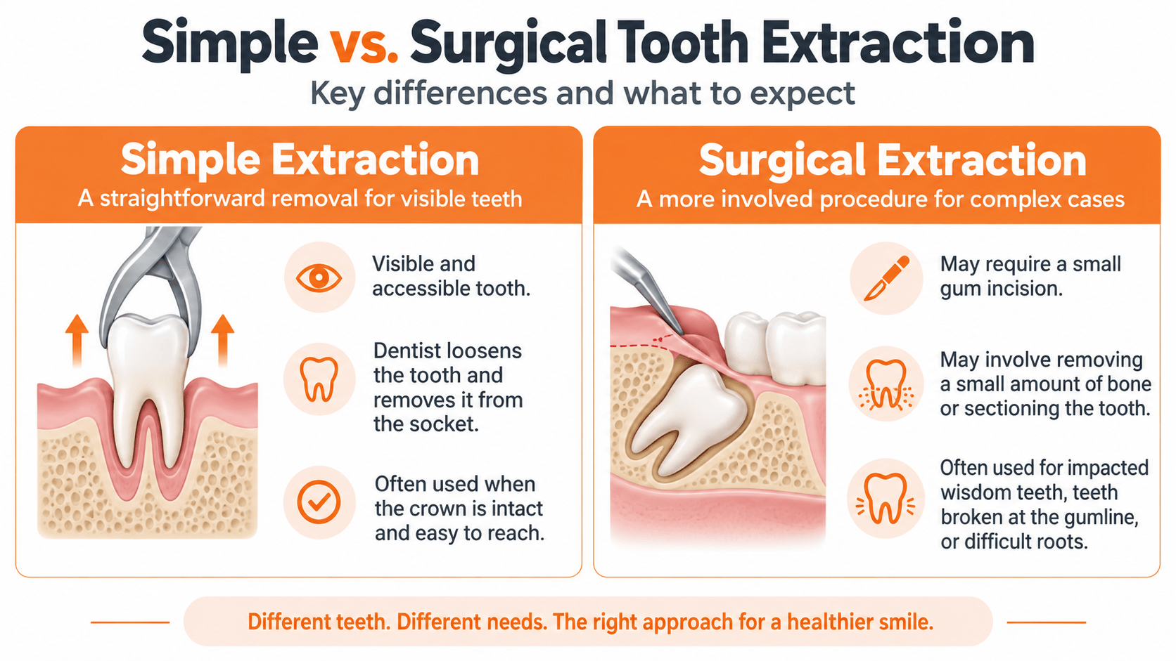 Simple vs. surgical tooth extraction comparison showing when each procedure is used and what to expect